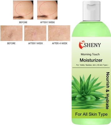 Sheny Aloe Vera Lotion Green Tea Extract & Vitamin E 200ML(200 ml)