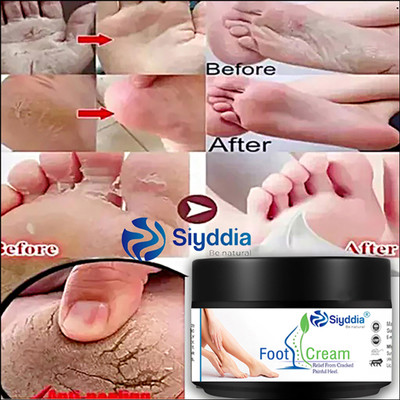 SIYDDIA Crack Cream For Cracked ,Dry & Dehydrated Skin-50g(50 ml)