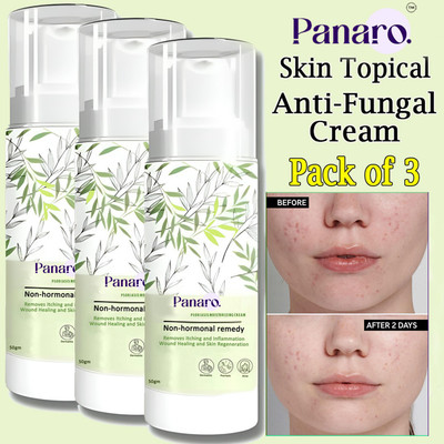 PANARO Eczemaron Anti Fungal Cream For Men & Women | Fungus Protection | Pack of 3(150 g)