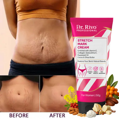 Dr rivo professional Stretch Mark Cream | Safe for Daily Use | With Vitamin E, Shea, Cocoa Butter |(50 g)