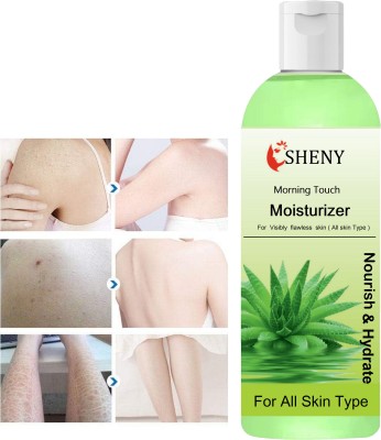 Sheny Aloe Vera Lotion For Skin Acne, Scars, Dark spots Face 400 ml(400 ml)