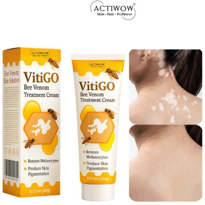 ACTIWOW Vitigo Bee Venom Cream for Travel Day Protection cream Moisturizer(100 g)