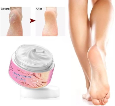 MYEONG Heel Repair Foot Crack Cream Women Men Moisurization and Hydration Cream(50 g)