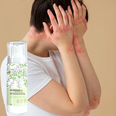 Barbers Crew Eczemaron Psoriasis Anti Fungus Relief Cream Soothing and Moisturizing(50 g)