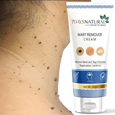 Acne 7DaysNatural wart remover cream(50 g)