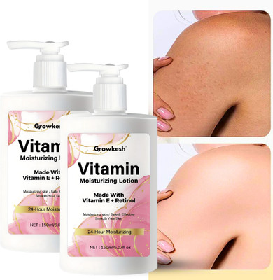 Growkesh Body Moisturising Lotion for Visibly Reduces Pigmentation, Patchy Skin(150 ml)