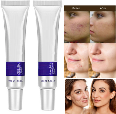 Emijun Night Cream For Acne Remover Age Spots And clean open pores(60 g)