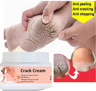 Jiwoo Feet Crack Heel Repair Cream Smooth Foot Crack Cracked Heel Repair for Women(50 g)