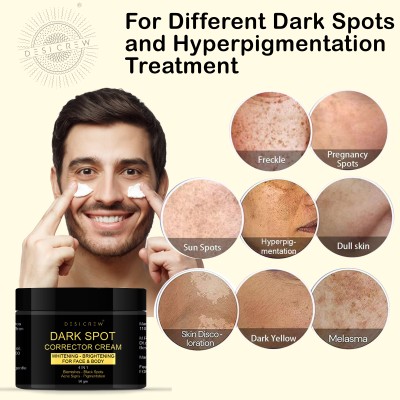 Desi Crew Dark Spot Remover Cream, Pimple Marks, Acne Scar, Pigmentation & Blemish Removal(50 g)