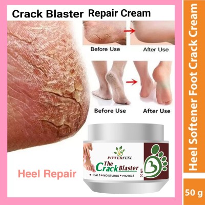 POWERFEEL Crack Heel Repair Cream. Crack Blaster Repair Cream(50 g)