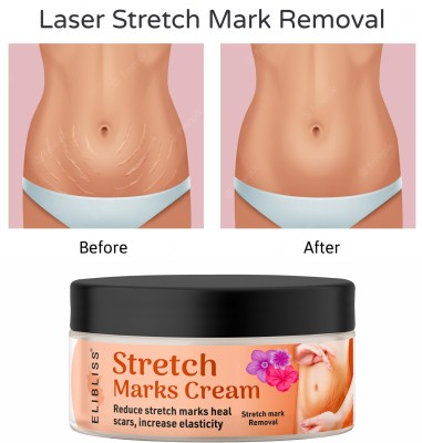 ELIBLISS Stretch Marks Removal Cream(50 g)