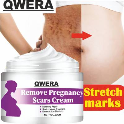 Qwera Stretch Marks Cream to Reduce Stretch Marks & Scars