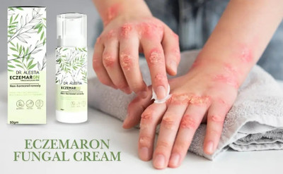 dr. alestia Eczemaron Anti Fungal Creamm For Men & Women(50 g)