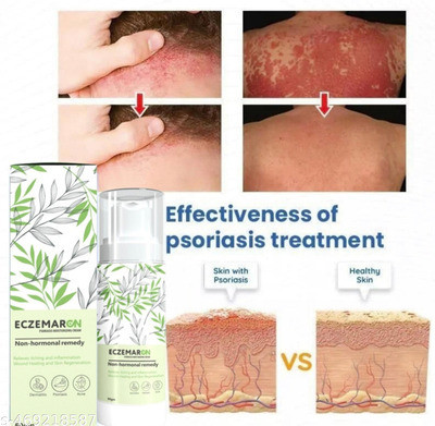 Kenkoderm Eczemaron Anti Fungal Cream Spray for Comfort and Care(50 ml)