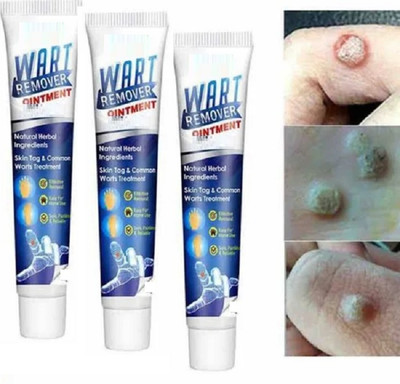 HUZURLU wart remover liquid Cream Gel(300 ml)