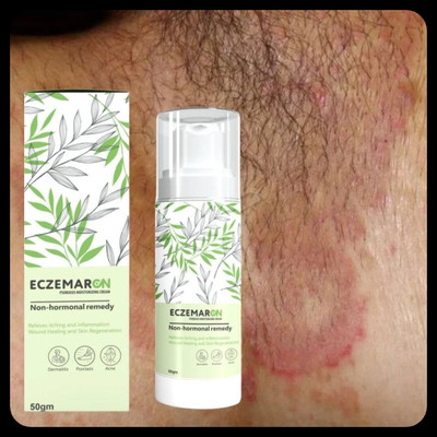 BUZIVENTURES Eczemaron Anti Fungal for Soft, Moisturized Skin_MZ115(50 g)