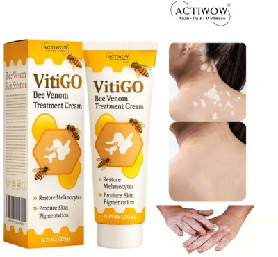 ACTIWOW Vitigo Bee Venom Cream for Rash Prevention cream Moisturizer(100 g)