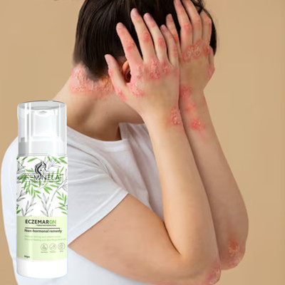 Feminela Eczemaron Herbal Relief Cream – Advanced Soothing & Moisturizing Formula(50 g)