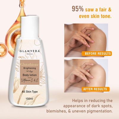 GLAMVEDA Glutathione Body Lotion Reduces acne scars with Vitamin C For Skin fairness(150 ml)