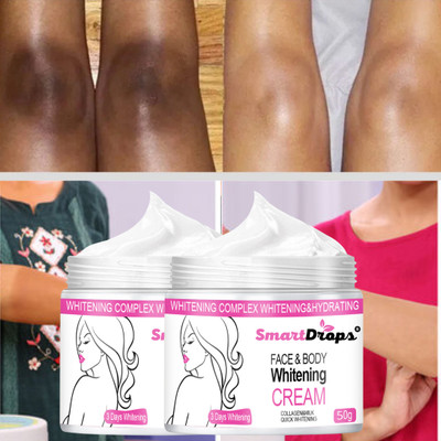 smartdrops Whitening Moisturizer Cream for Face & Body | Suitable for Men & Women(100 g)
