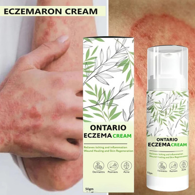 Ontario Herbal Eczemaron Cream Pack Of 1.2(50 g)