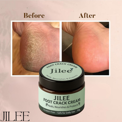jilee Heel Repairing Cream for Dry and Cracked Foot. Men and Women(50 g)