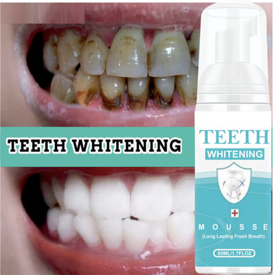 INDO CHALLENGE Teeth Whitening Foam to Ultra-fine Deeply Clean Gums Intensive Stain Removal - Mint Flavor(50 ml)