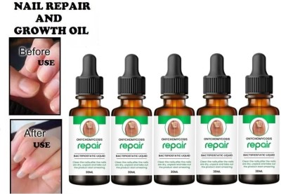 house of common Professional Nail Repair Serum Helps strengthen breaking nails (30ml) Pack of 5 Natural