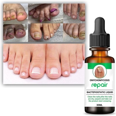 JENIM Professional Nail Repair Serum Helps strengthen breaking nails malticolur