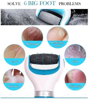 GABBU Pedicure Scrubber Electronic Dry Foot File