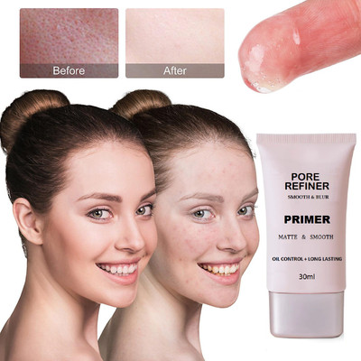 winry BEST ALL SKIN TYPE PRIMER FOR WOMANS AND GIRLS Primer  - 30 ml(TRANSPARENT)