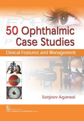 50 Ophthalmic Case Studies: Clinical Features And Management(Paperback, Sanjeev Agarwal)