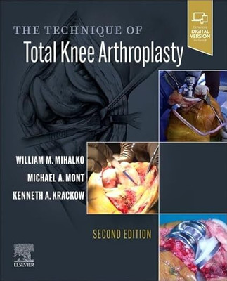The Technique Of Total Knee Arthroplasty-2E(Hardcover, Martin J. Blaser MD)