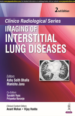 Clinico Radiological Series: Imaging Of Interstitial Lung Diseases(Paperback, ASHU SEITH BHALLA)