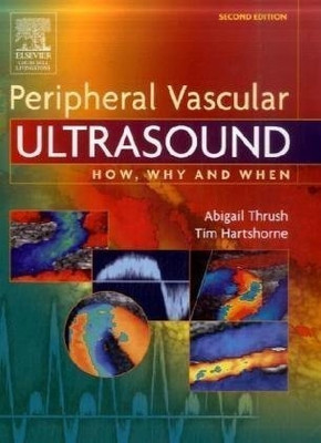 Peripheral Vascular Ultrasound: How, Why And When(Paperback, Abigail Thrush, Timothy Hartshorne)