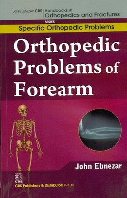 John Ebnezar CBS Handbooks In Orthopedics And Factures (English, Paperback, Ebnezar John)(Paperback, Ebnezar John)