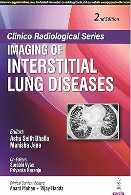 Clinico Radiological Series Imaging Of Interstitial Lung Diseases(Paperback, Ashu Seith Bhalla and Manisha Jana)