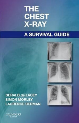 The Chest X-Ray: A Survival Guide(Paperback, Gerald de Lacey, Simon Morley, Laurence Berman)