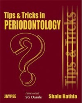 Tips & Tricks In Periodontology(Paperback, SHALU BHATLA)