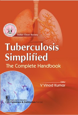 Tuberculosis Simplified The Complete Handbook(Paperback, V Vinod Kumar)