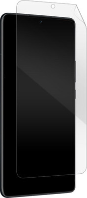 Siva Front and Back Screen Guard for Xiaomi 11I 5G / 11I Hypercharge 5G(Pack of 1)