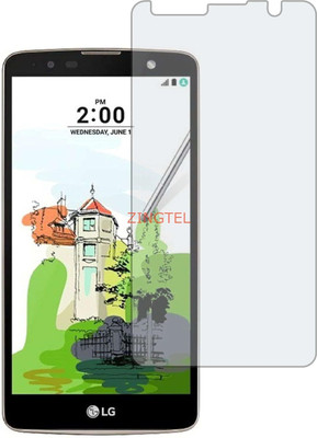 Mobotize Impossible Screen Guard for LG Stylus 2 Plus(Matte Finish for Gaming)(Pack of 1)