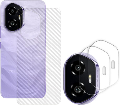 SOMTONE Screen Guard for Honor 300 5G Camera Lens Glass Protector | Anti-Scratch | Edge to Edge Full Coverage | 9H Hardness (BACK CARBON FIBER SKIN + CAMERA LENS PROTECTOR)(Pack of 2)