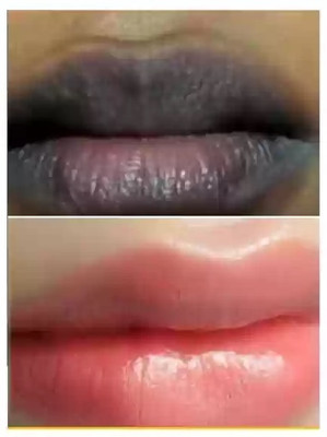 AFARAXIA Lip Scrub Balm for Lightening and Brightening Dark Lips - Lip  Scrub(10 ml)
