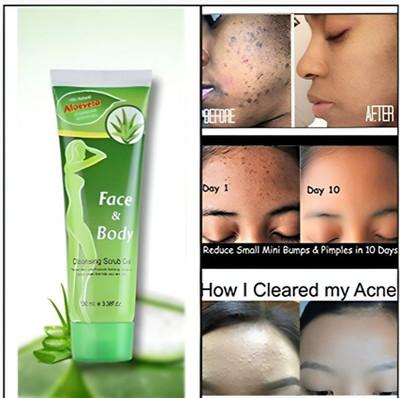 Rudvya Aloe Vera Face Scrub -For Women & Men For All Skin Types No Paraben Scrub(100 ml)