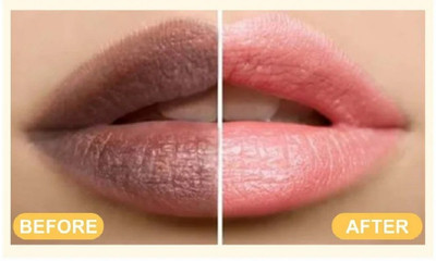 Bijlan Cosmetic Lip Scrub For Lightening Brightening Dark Lips* Scrub(9 ml)