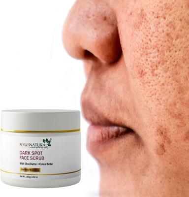 7days natural Dark Spot Removal Scrub Cream pigmentation Daag, dhabbe, jhaiyan Scrub(100 g)