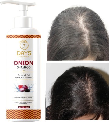 7 Days Premium Faster Onion Black seed Hair Fall Shampoo for Hair Growth & Hair Fall Control, with Onion Oil & Plant Keratin Men & Women(300 ml)