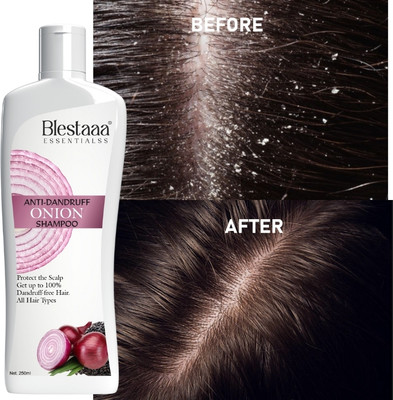blestaaa essentialss Fresh ONION Anti Dandruff Shampoo and Conditioner | Controls Dandruff(250 ml)