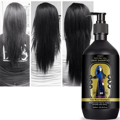 vvqvv Ginger Extract Hair Nourishing Shampoo – Promote Healthy Hair Growth(300 ml)